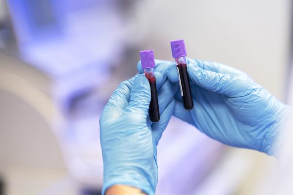 Análisis de sangre - Análisis clínicos en Bizkaia